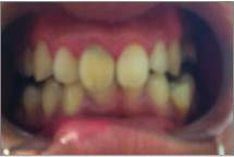 BEFORE.....AFTER 3