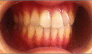 BEFORE.....AFTER