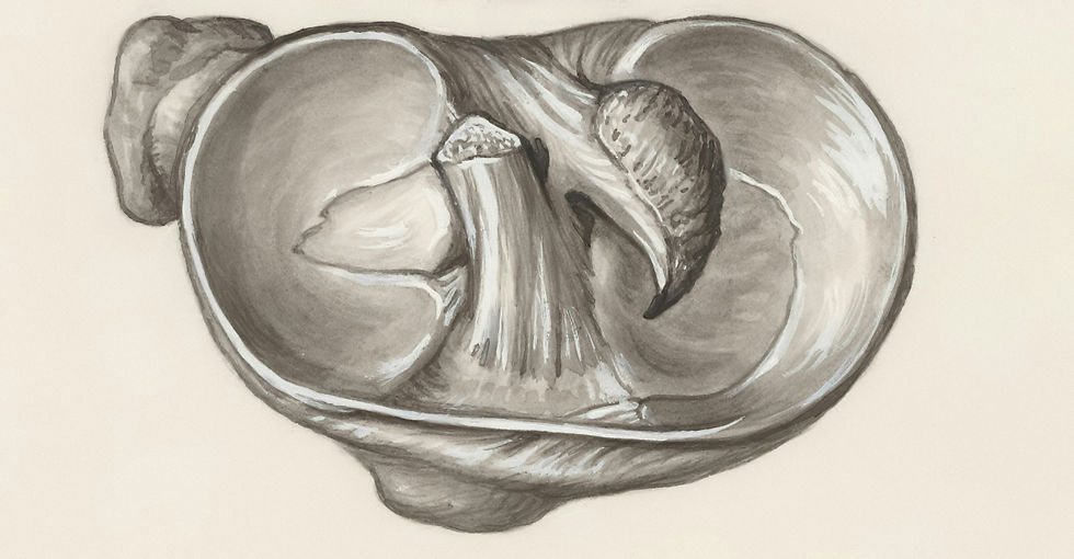 CONCERN: Meniscus Injury
