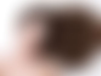 תוספות שיער להתקרחות נשים