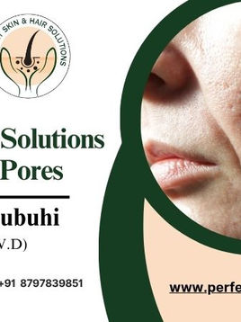 Best Clinical Solutions for Enlarged Pores | Perfect Skin & Hair Solutions