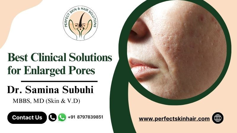 Clinical Solutions for Enlarged Pores