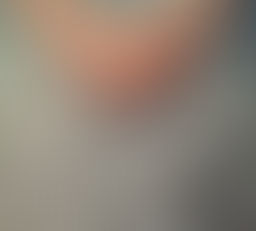 Mieux comprendre la sarcopénie pour la gérer au quotidien