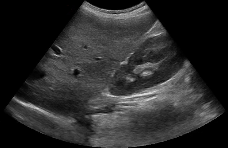 abdomen_normal-3-2.gif