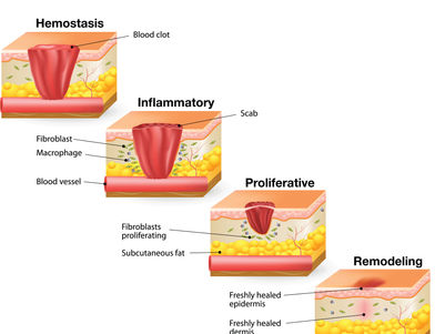Reflection: Pathophysiology Assignment