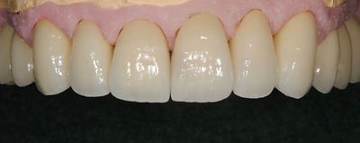 img_zirconia.jpeg