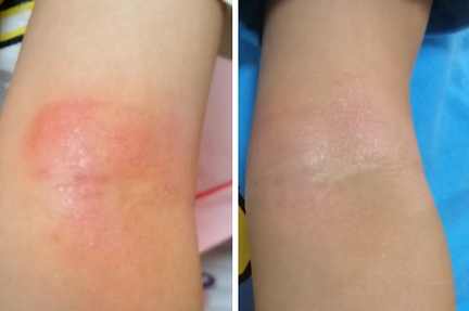 before after kid.PNG