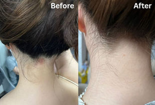 濕疹必備良物 卡倫萬用膏