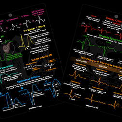 The ECG Card | FOAMfrat
