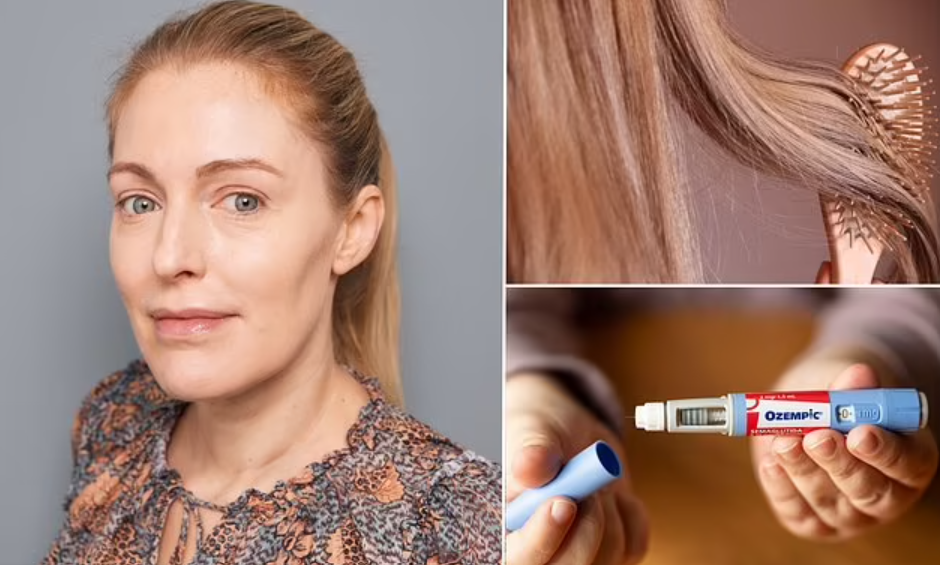 Understanding the Connection Between GLP-1 Medications and Hair Loss