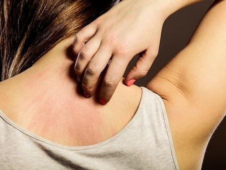 O que é alergia emocional, sintomas e tratamento