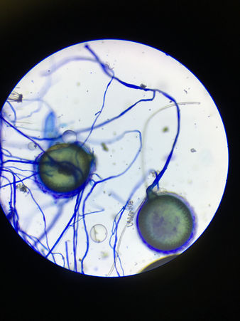 Mycorrhiz(_) &
Fung(_) Usage