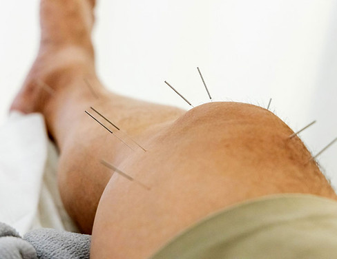 acupuncture for knee pain vermont