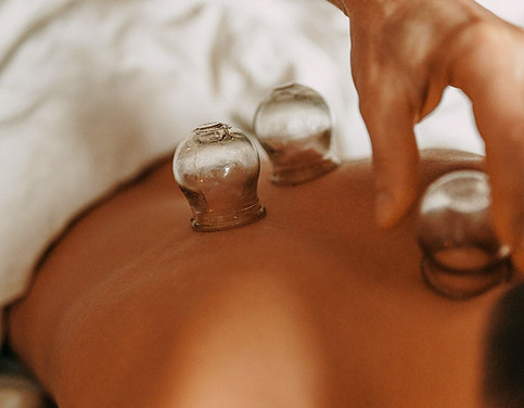 Cupping Therapy Energy Healing in Vermont