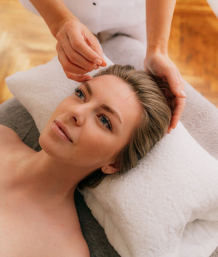 Cosmetic Acupuncture in Vermont