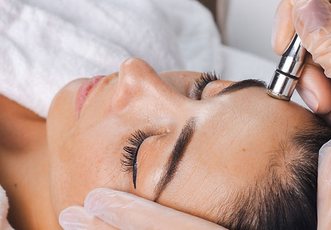 Microneedling, facial acupuncture, and skin rejuvenation in Burlington Vermont