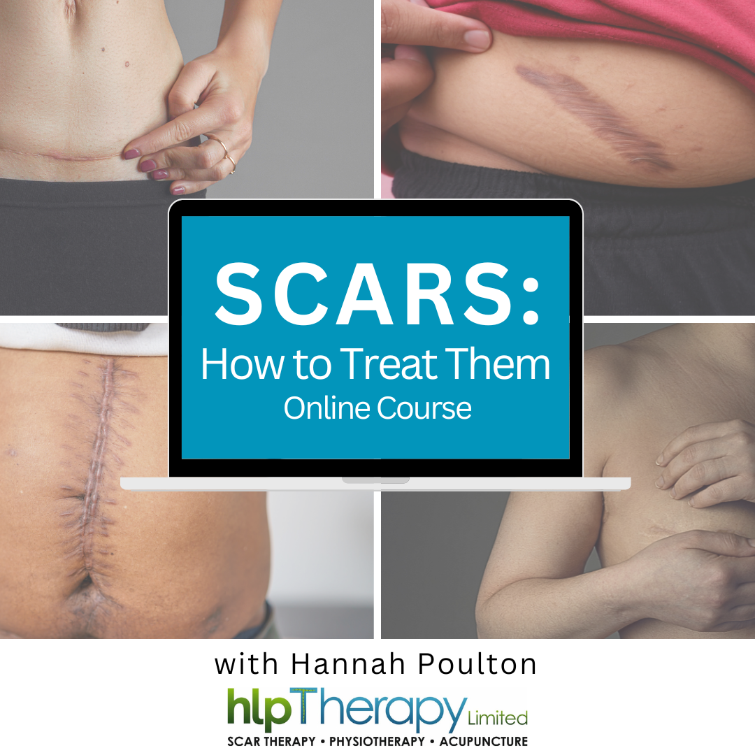 Each corner of the square image shows a different type of scar. The text box in the middle says 'Scars: How to Treat them'