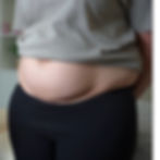 An image of a lady's grey t-shirt rolled up to show her C section overhang above her C Section scar.
