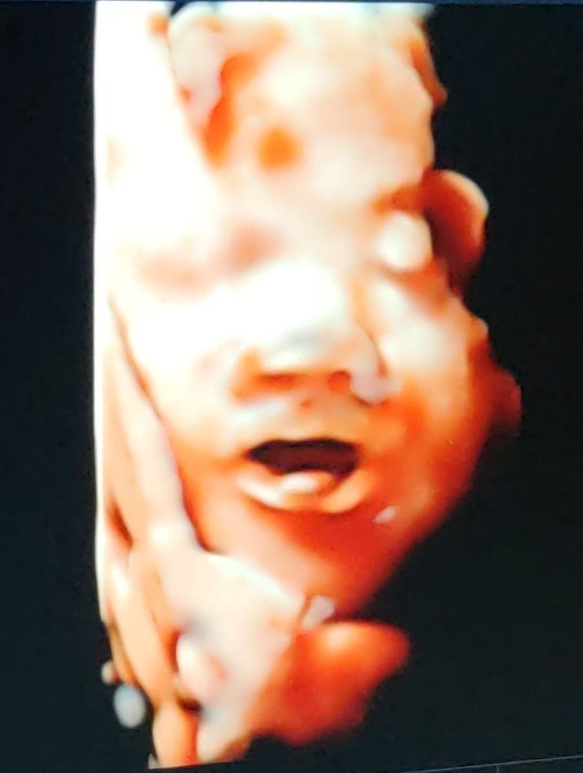 When Is the Best Time for a 3D/4D Ultrasound? Timing Tips for Picture-Perfect Baby Photos