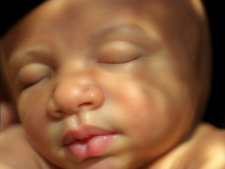 3D vs. 4D vs. HD Ultrasound: What's the Difference — and Which Is Right for You?