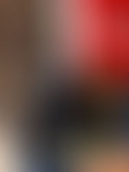 Latinoamérica aún no reporta casos de nueva variante de viruela del mono