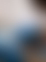 México reporta 2.147 casos de viruela del mono, 179 en la última semana