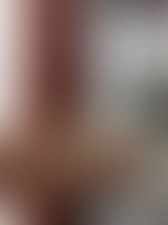 Más de 100 personas usan nuevo tratamiento para prevenir la transmisión de VIH: Dr. Pepe Cruz