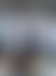 Suman mil 378 casos de COVID-19 y 37 defunciones en México