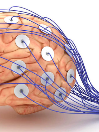 Crece neurofobia en México; hay pocos especialistas