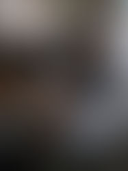 Exhortan a incrementar vacunación ante brotes de tosferina y sarampión