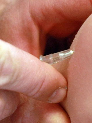 No hay casos de sarampión en el estado, hasta el momento