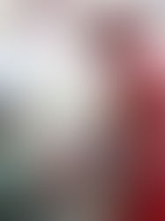 Atención oportuna en el bebé prematuro reduce cifras de mortalidad