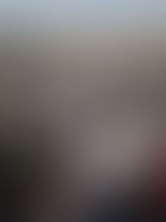 La ONU denuncia casi 5.000 heridos en Gaza mientras buscan comida y pide facilitar reparto