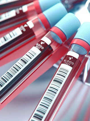 Crean una nueva tecnología que detecta 13 tipos de cáncer con una gota de sangre