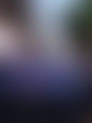 Continúan protestas de médicos y magisterio hondureños