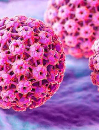 Papiloma, enfermedad de transmisión sexual más común