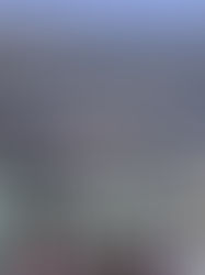 El capo Rafael Caro Quintero se somete a cirugía