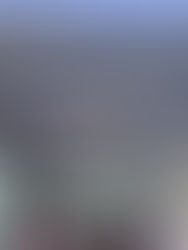 El capo Rafael Caro Quintero se somete a cirugía