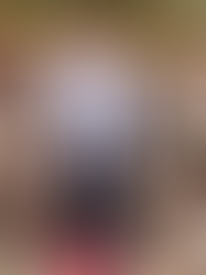 Necesario que la población elimine criaderos de mosquitos para evitar enfermedades por vector