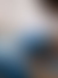 México confirma 1.968 casos de viruela símica y el 98 % son hombres