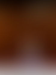 Un 25 % de pacientes del sector público acuden a clínicas privadas en México