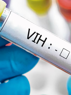 Casos no detectados de VIH son potencialmente peligrosos