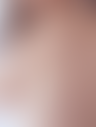 Las muertes por sarampión descienden a un nivel récord en el mundo