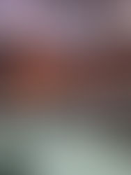 Piden hasta 20 años de cárcel por lesionar con ácido a mujeres