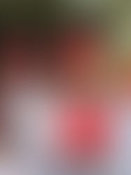 Por COVID-19 han muerto 380 mil 180 personas en todo el mundo