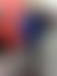 Un hombre paralítico pudo volver a caminar gracias a un implante experimental