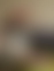 Infantes con cáncer necesitan tratamientos, antes de un apoyo bimestral