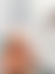 Dos de cada 100 chiapanecos padecen cáncer de riñón