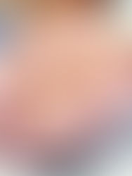 Cuidados paliativos: ¿necesarios o extremistas?