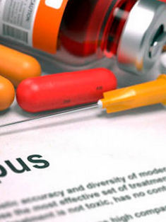 En México, 9 de cada 10 mujeres afectadas por lupus son jóvenes